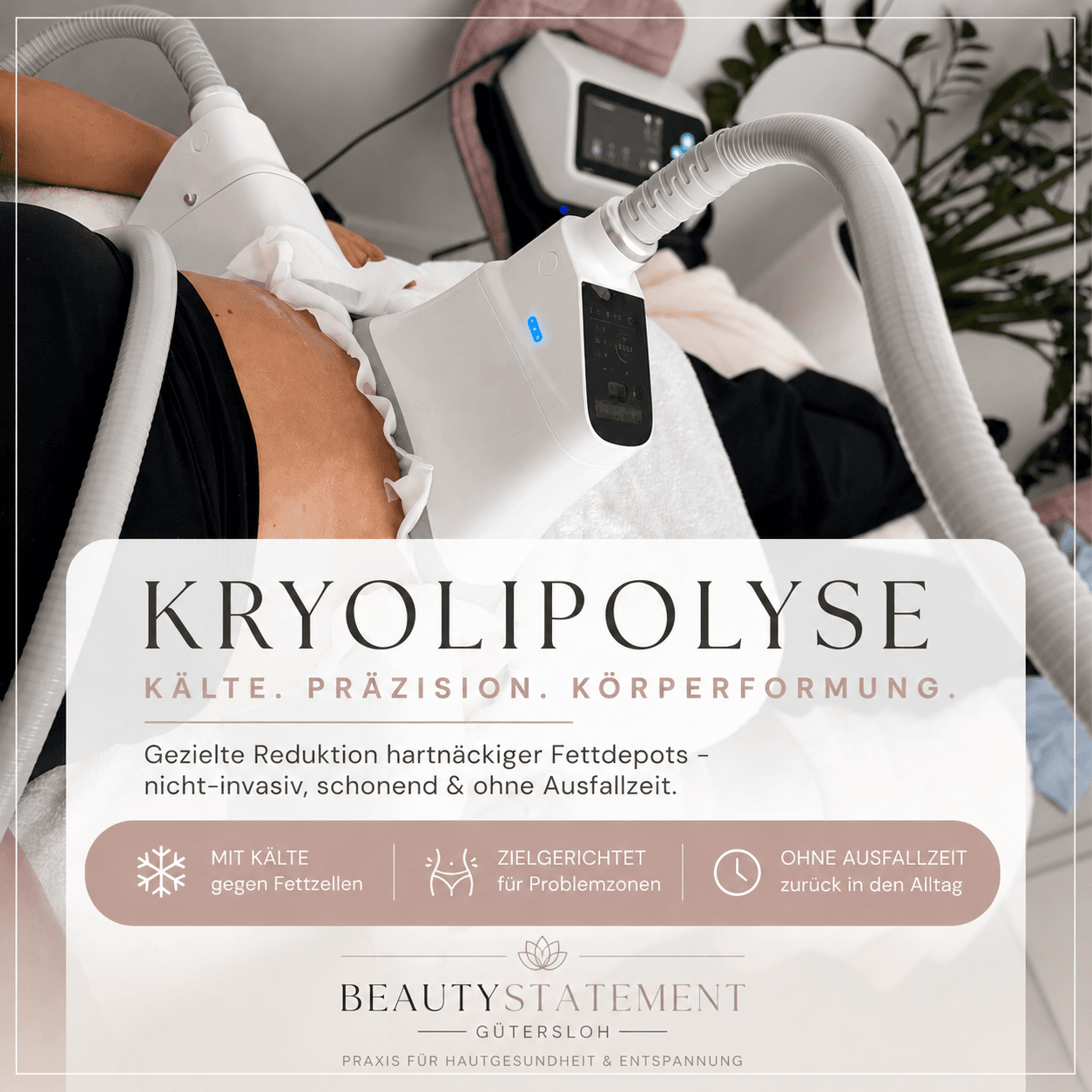 Kryolipolyse in Gütersloh – Was die Behandlung wirklich kann — Beautinda Blog